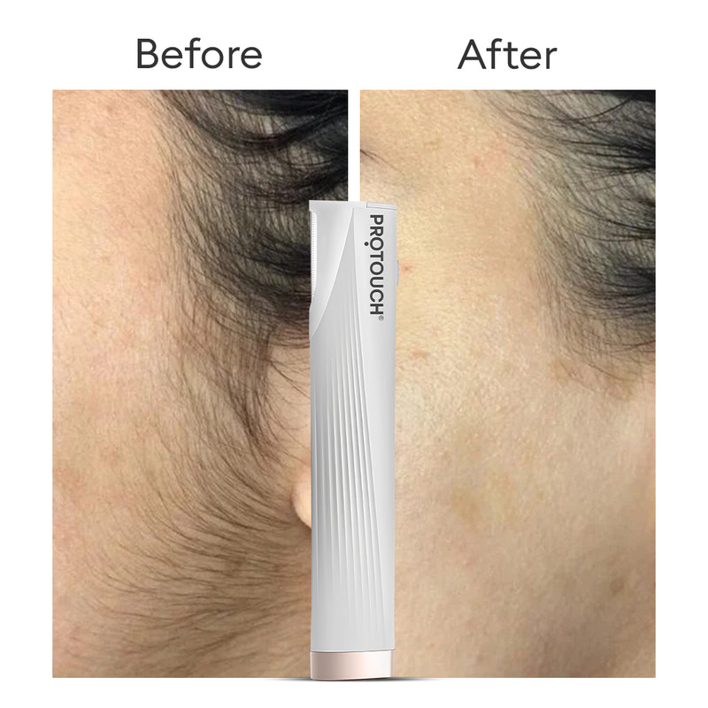 Dermaplaning Device | Electric 2 in 1 Facial Hair Removal & Eyebrow Grooming Device