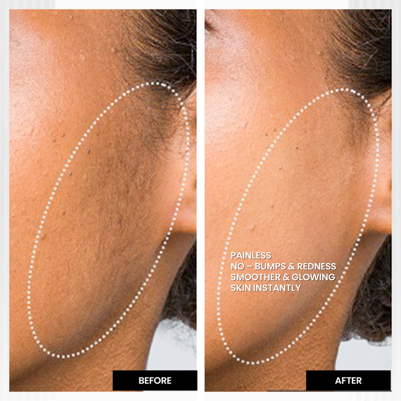 Derm + Glow Duo | 2-step facial hair removal & aftercare combo