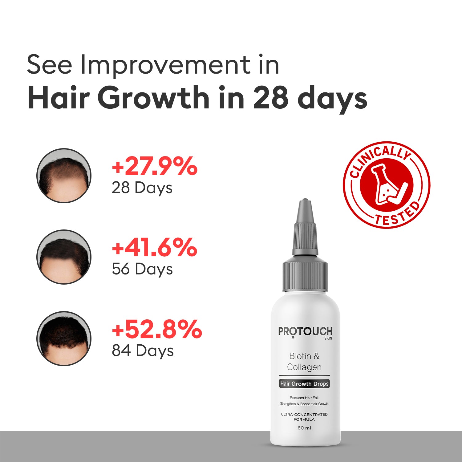 Complete Scalp Combo | for Dandruff & Hair Growth