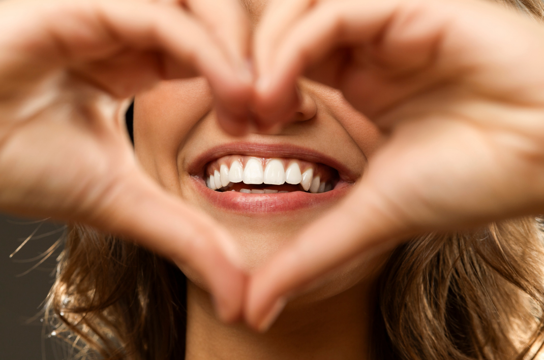 Whiter the Smile, Brighter you Shine!