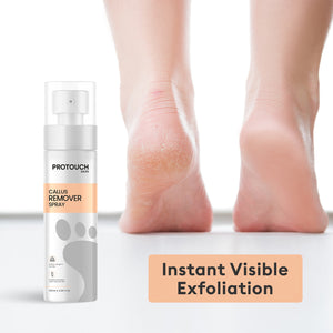 Protouch Callus Remover Spray | Potent Formula to Remove the tough dead skin & reveal Soft Heels