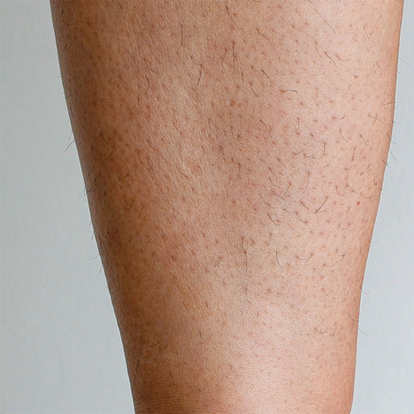 Visible leg hair